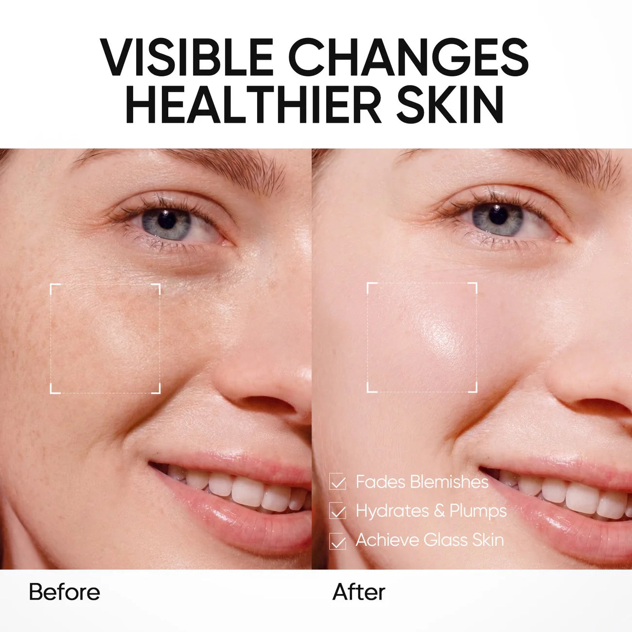 Ōlana™ PDRN Bright & Smooth Moisture Gel